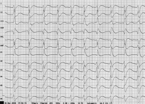 https://cdn.ncbi.nlm.nih.gov/pmc/blobs/9aff/2769357/1124e9e60f1f/1757-1626-0002-0000007501-001.jpg