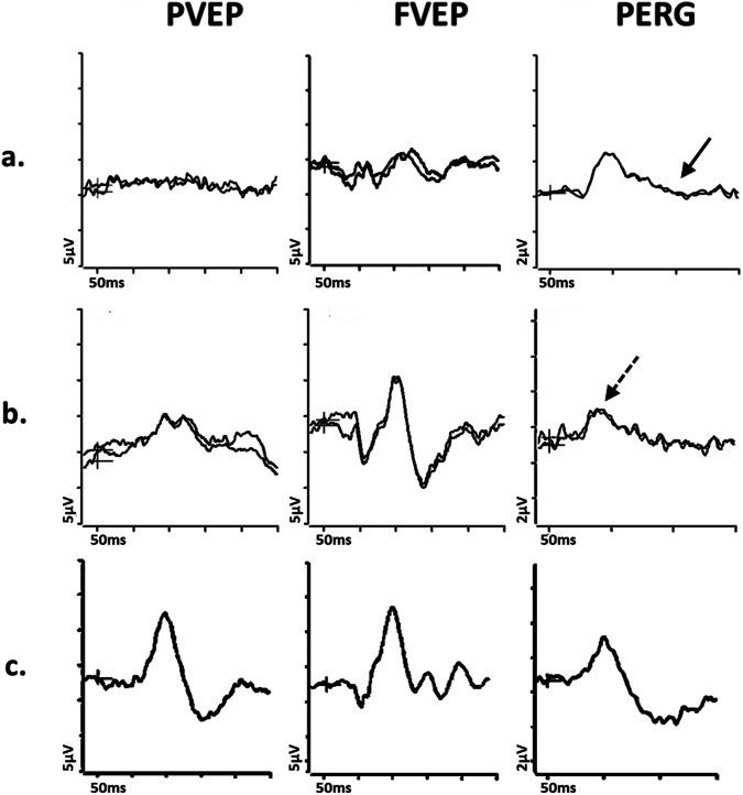 https://cdn.ncbi.nlm.nih.gov/pmc/blobs/9b00/11306601/33ae738274f8/41433_2024_3154_Fig2_HTML.jpg