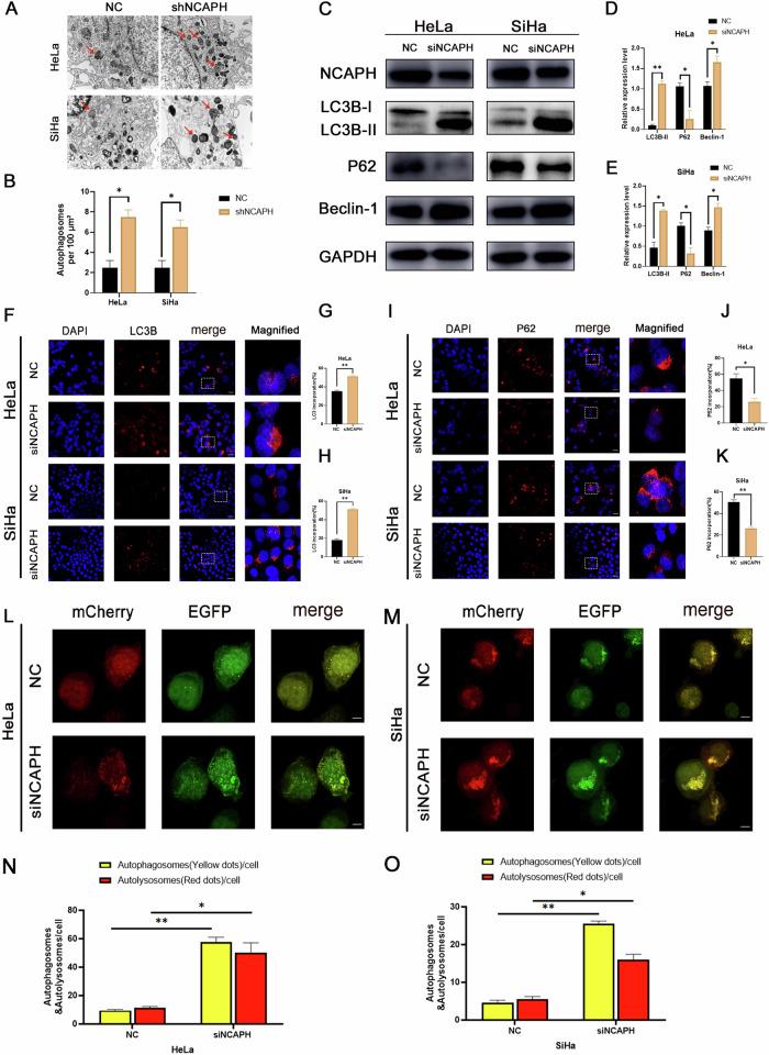 https://cdn.ncbi.nlm.nih.gov/pmc/blobs/9b01/11300717/3dbc83947f9b/41419_2024_6932_Fig1_HTML.jpg