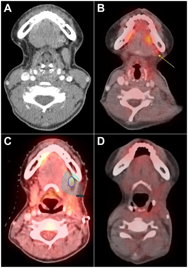 https://cdn.ncbi.nlm.nih.gov/pmc/blobs/9b07/12349773/cacb5d32f44f/pkaf077f2.jpg