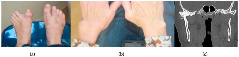 https://cdn.ncbi.nlm.nih.gov/pmc/blobs/9b0c/7997293/18e93bc85a8a/diagnostics-11-00409-g002.jpg