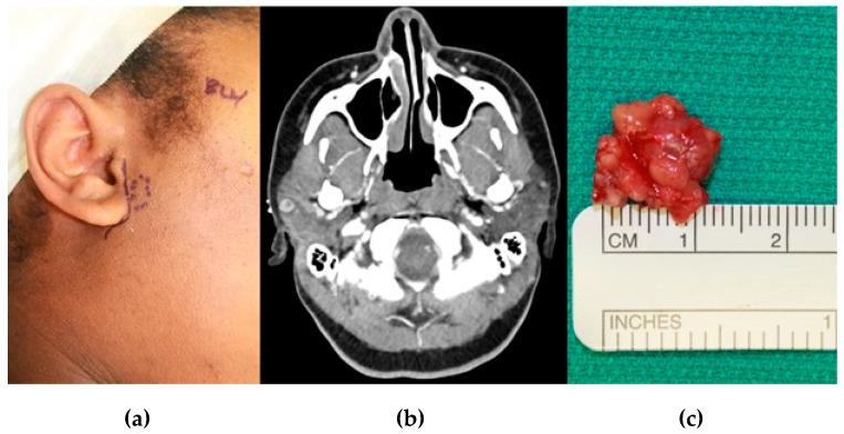 https://cdn.ncbi.nlm.nih.gov/pmc/blobs/9b0c/7997293/f51a0bc356c3/diagnostics-11-00409-g001.jpg
