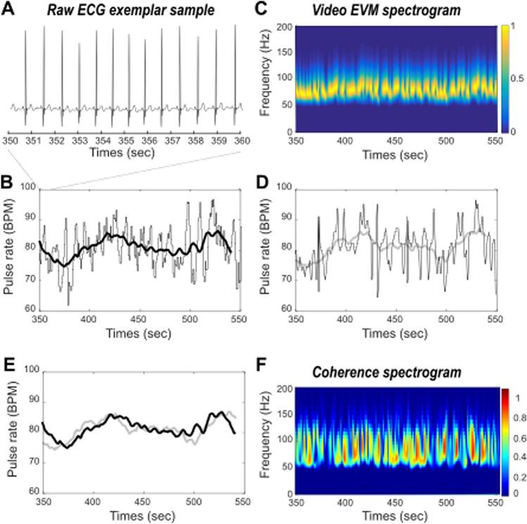 https://cdn.ncbi.nlm.nih.gov/pmc/blobs/9b15/7578008/be47d55de415/41598_2020_74954_Fig2_HTML.jpg