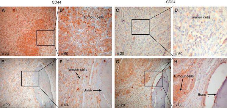 https://cdn.ncbi.nlm.nih.gov/pmc/blobs/9b1d/3694250/1706a8fea215/bjc2013271f4.jpg