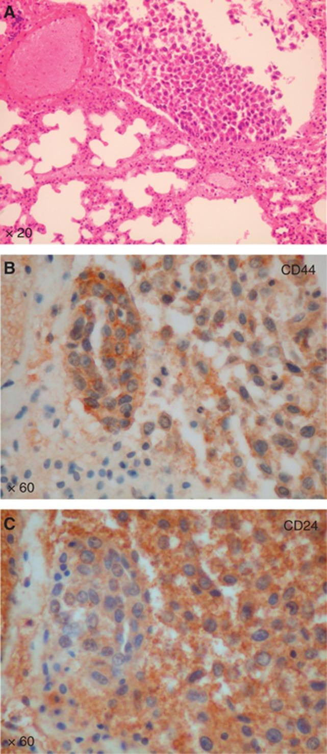 https://cdn.ncbi.nlm.nih.gov/pmc/blobs/9b1d/3694250/6fd7b97d713d/bjc2013271f7.jpg