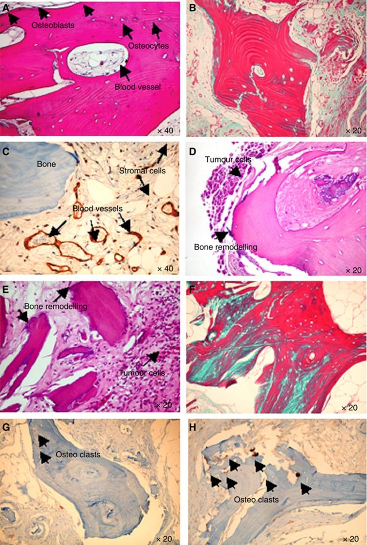 https://cdn.ncbi.nlm.nih.gov/pmc/blobs/9b1d/3694250/c0a4c82c29e3/bjc2013271f2.jpg