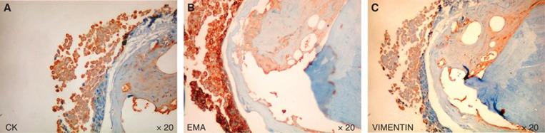 https://cdn.ncbi.nlm.nih.gov/pmc/blobs/9b1d/3694250/f517b74b76c4/bjc2013271f5.jpg