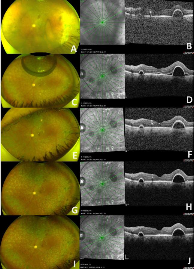 https://cdn.ncbi.nlm.nih.gov/pmc/blobs/9b1e/11334301/c164557a15ac/12886_2024_3636_Fig1_HTML.jpg