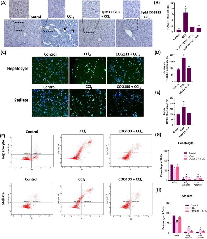 https://cdn.ncbi.nlm.nih.gov/pmc/blobs/9b1f/12181747/d6dd852ef14e/JCMM-29-e70677-g001.jpg
