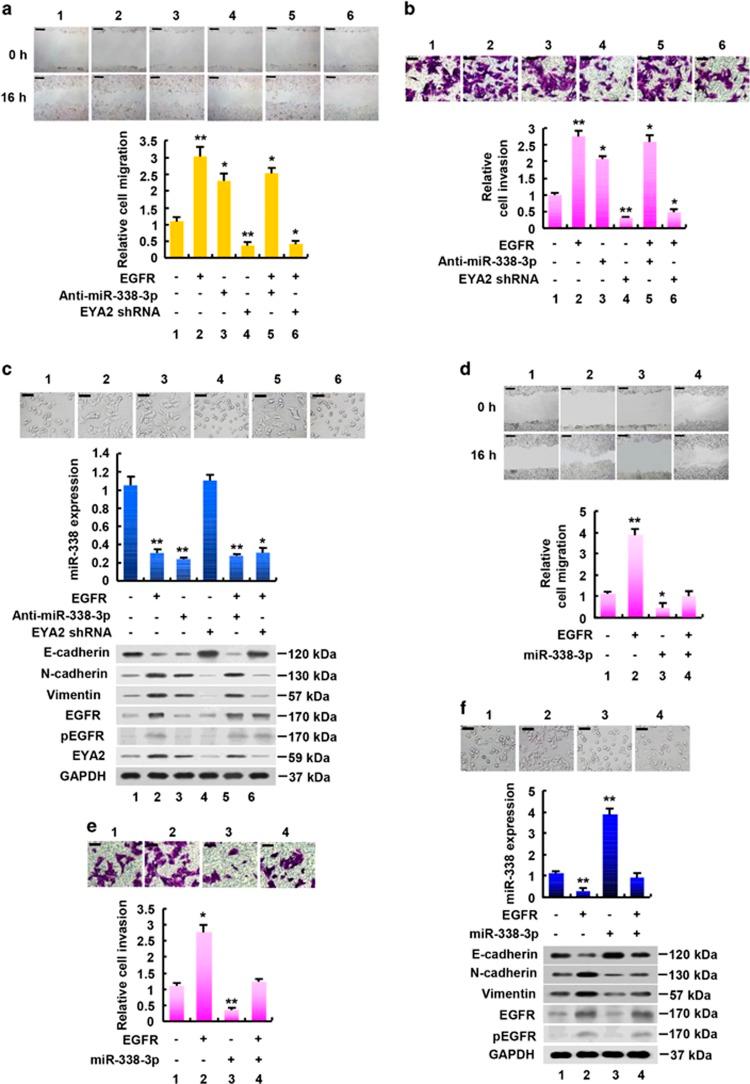 https://cdn.ncbi.nlm.nih.gov/pmc/blobs/9b22/5550870/bd64e288bf73/cddis2017325f5.jpg