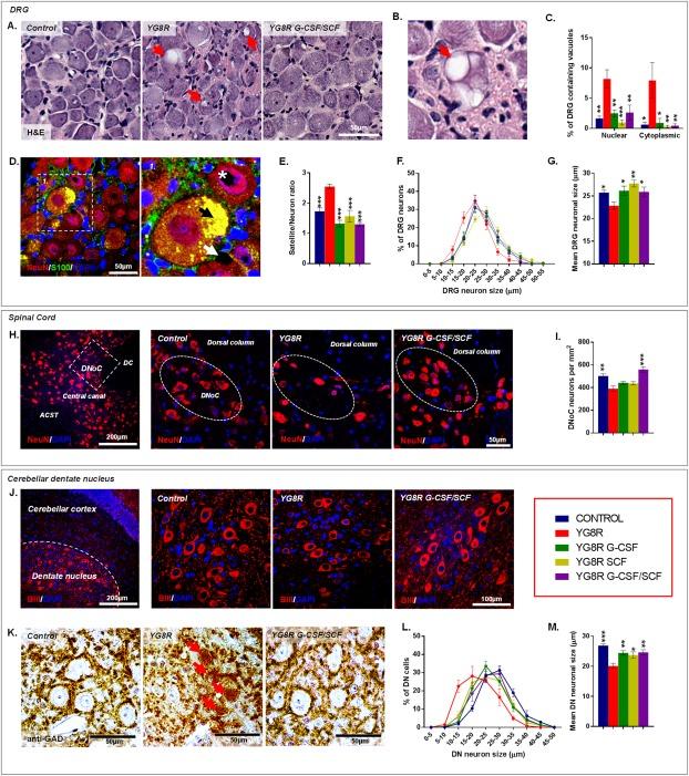 https://cdn.ncbi.nlm.nih.gov/pmc/blobs/9b2b/5324580/df064830f319/ANA-81-212-g006.jpg