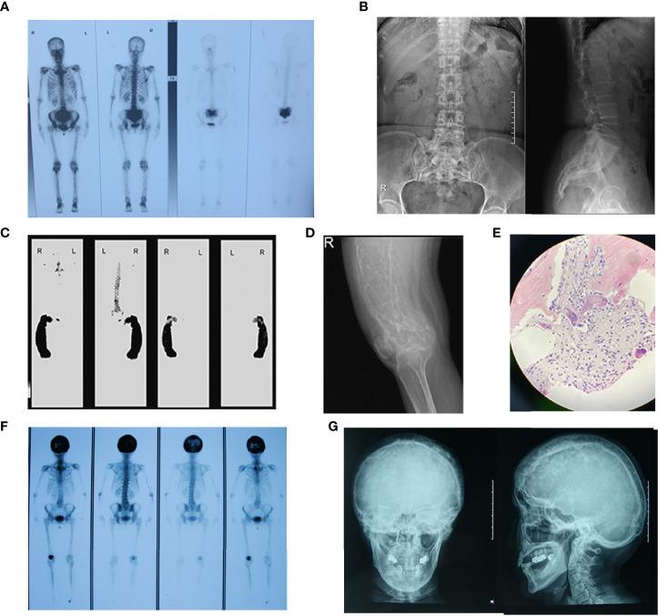 https://cdn.ncbi.nlm.nih.gov/pmc/blobs/9b2c/8959906/f243405f8c7b/fendo-13-850462-g002.jpg