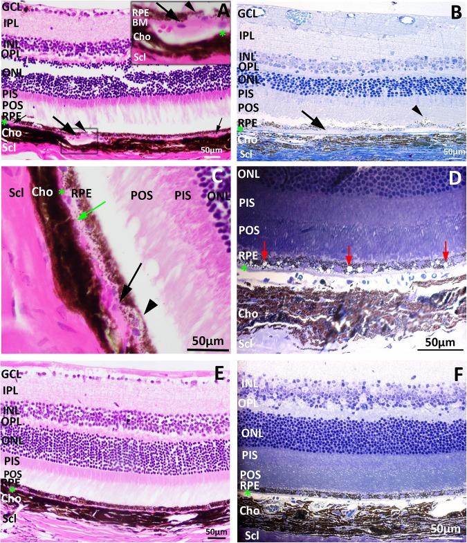 https://cdn.ncbi.nlm.nih.gov/pmc/blobs/9b2d/5345864/7aa35a1b4182/pone.0173716.g003.jpg