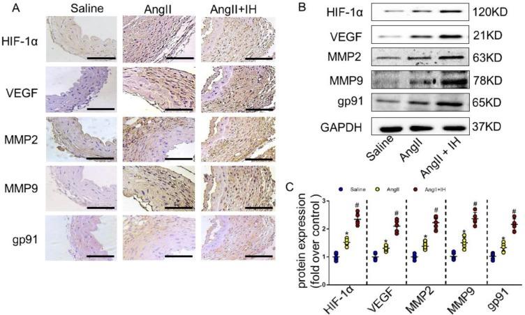 https://cdn.ncbi.nlm.nih.gov/pmc/blobs/9b2e/6909961/07cdd4a1d85d/ijbsv15p2774g002.jpg