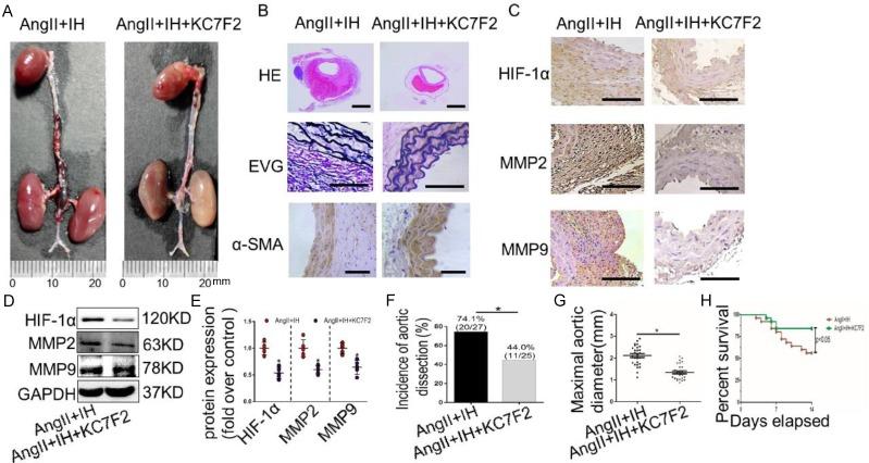 https://cdn.ncbi.nlm.nih.gov/pmc/blobs/9b2e/6909961/fd454962a14b/ijbsv15p2774g005.jpg