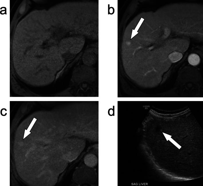 https://cdn.ncbi.nlm.nih.gov/pmc/blobs/9b31/12335345/4b20f77a52b2/JMRI-62-640-g008.jpg
