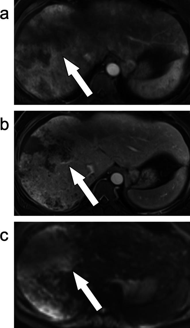 https://cdn.ncbi.nlm.nih.gov/pmc/blobs/9b31/12335345/682322757c47/JMRI-62-640-g006.jpg