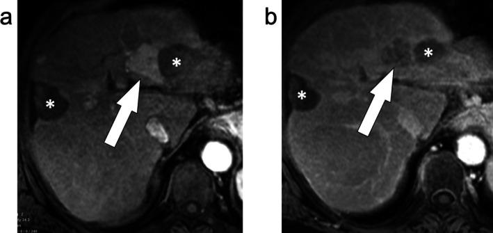 https://cdn.ncbi.nlm.nih.gov/pmc/blobs/9b31/12335345/6ad6dbdbf548/JMRI-62-640-g007.jpg