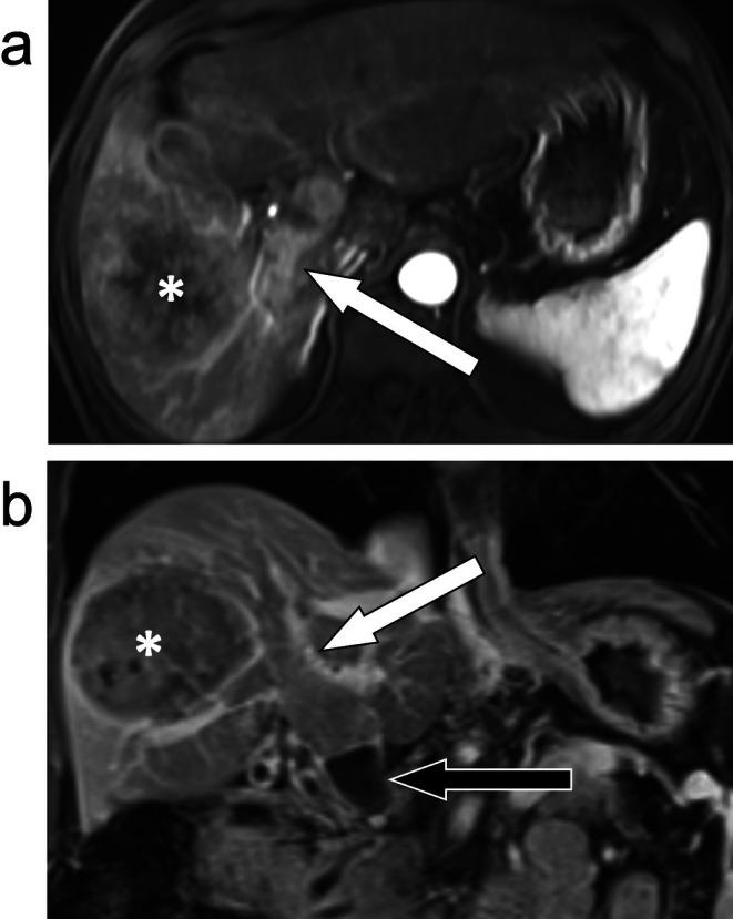 https://cdn.ncbi.nlm.nih.gov/pmc/blobs/9b31/12335345/8300b2176de0/JMRI-62-640-g005.jpg
