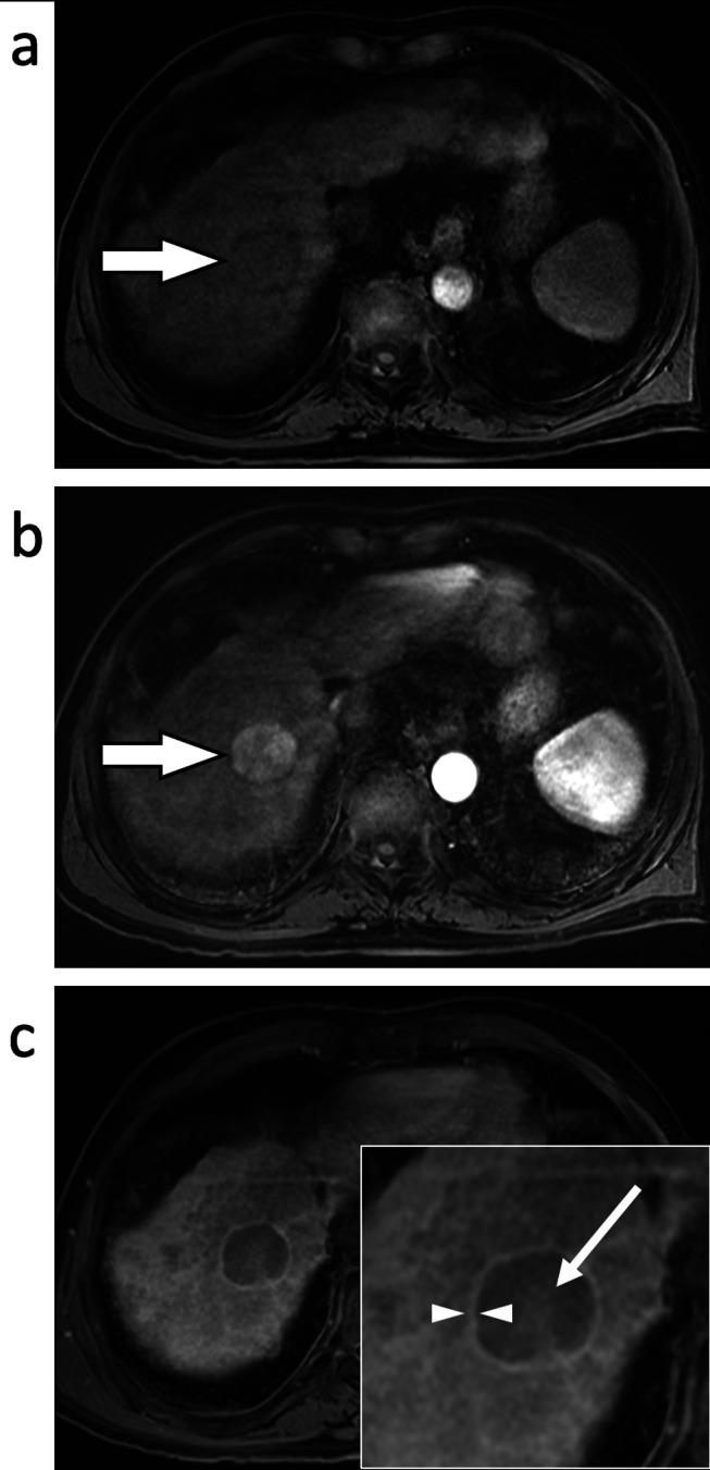 https://cdn.ncbi.nlm.nih.gov/pmc/blobs/9b31/12335345/d5c81f49291a/JMRI-62-640-g009.jpg