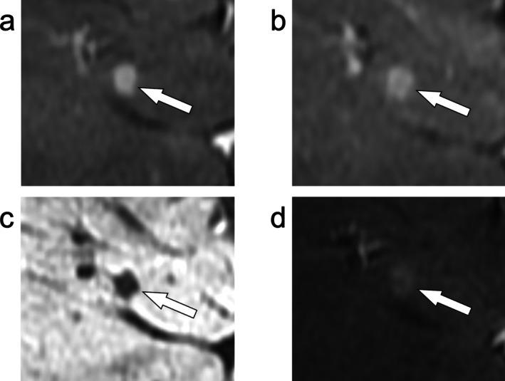 https://cdn.ncbi.nlm.nih.gov/pmc/blobs/9b31/12335345/dac137c01d16/JMRI-62-640-g002.jpg