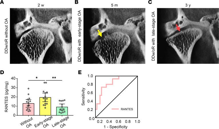 https://cdn.ncbi.nlm.nih.gov/pmc/blobs/9b31/9675482/b9bfc2db3155/jciinsight-7-158874-g255.jpg