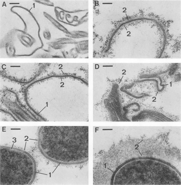 https://cdn.ncbi.nlm.nih.gov/pmc/blobs/9b34/259497/b23af80dcd8f/iai00080-0076-a.jpg