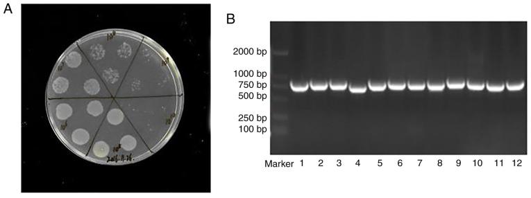 https://cdn.ncbi.nlm.nih.gov/pmc/blobs/9b38/7797424/07785f490509/IJMM-47-02-0708-g02.jpg