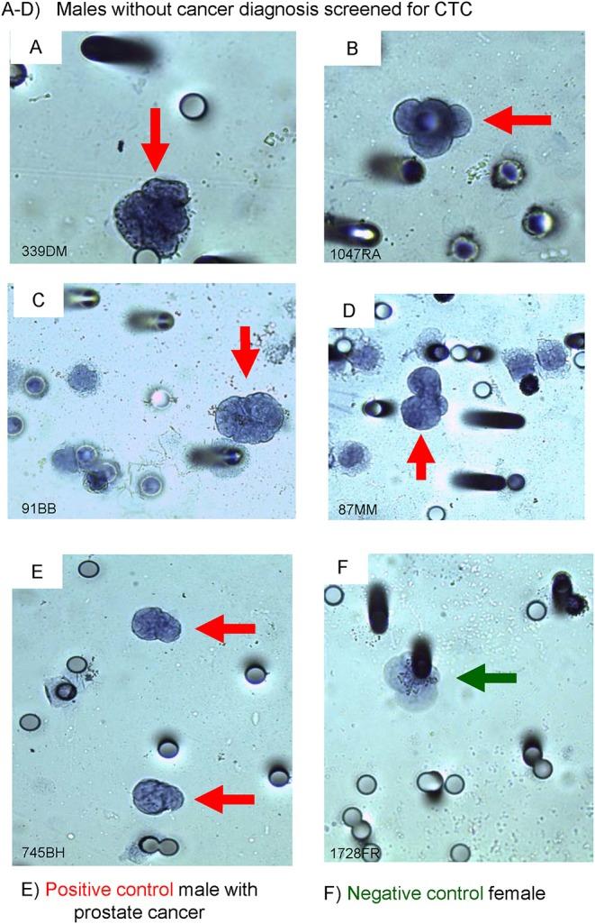 https://cdn.ncbi.nlm.nih.gov/pmc/blobs/9b3b/7192049/f27aa2f25ae9/fonc-10-00582-g0002.jpg