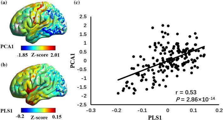 https://cdn.ncbi.nlm.nih.gov/pmc/blobs/9b40/10543112/7b3434623944/HBM-44-5387-g005.jpg