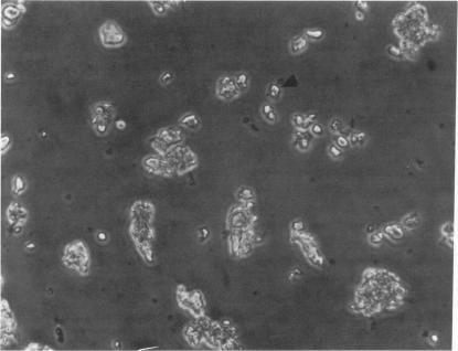 https://cdn.ncbi.nlm.nih.gov/pmc/blobs/9b41/1880665/b647fefcf50d/amjpathol00138-0154-a.jpg