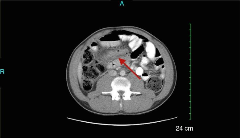 https://cdn.ncbi.nlm.nih.gov/pmc/blobs/9b41/4763559/208362183ce5/JCHIMP-6-30362-g001.jpg