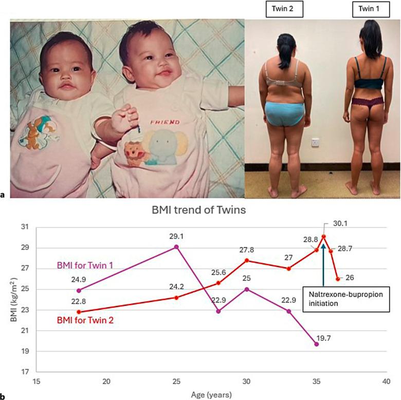 https://cdn.ncbi.nlm.nih.gov/pmc/blobs/9b45/12270488/d9dd3144a5e9/ofa-2025-0000-0000-546795_F02.jpg