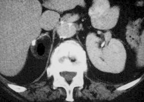 https://cdn.ncbi.nlm.nih.gov/pmc/blobs/9b48/4150587/4d54b0f0d5b3/gr6.jpg