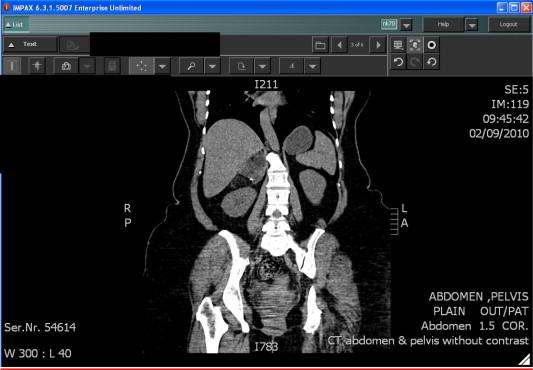 https://cdn.ncbi.nlm.nih.gov/pmc/blobs/9b48/4150587/c998a823dcc5/gr5.jpg