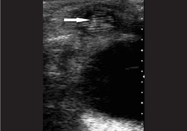 https://cdn.ncbi.nlm.nih.gov/pmc/blobs/9b49/3744785/aac1ce8957ed/IJO-61-298-g001.jpg