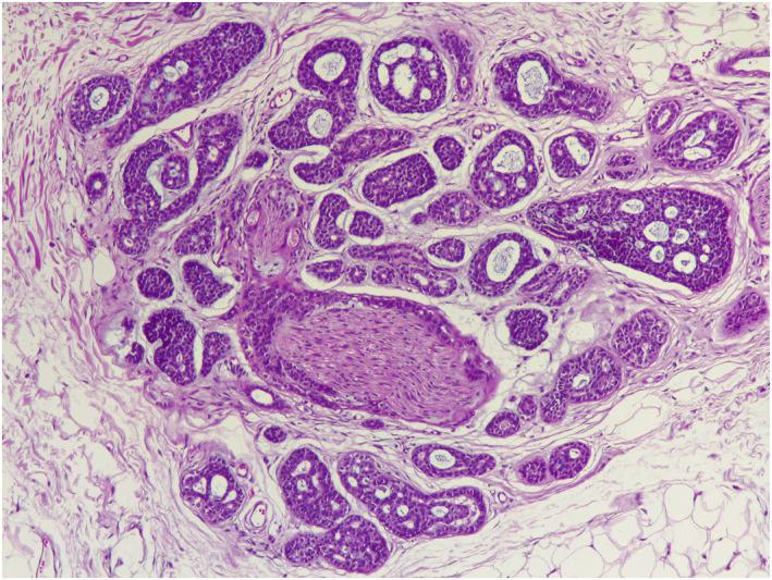 https://cdn.ncbi.nlm.nih.gov/pmc/blobs/9b4c/9168016/7250c5165259/SKI2-2-e118-g005.jpg
