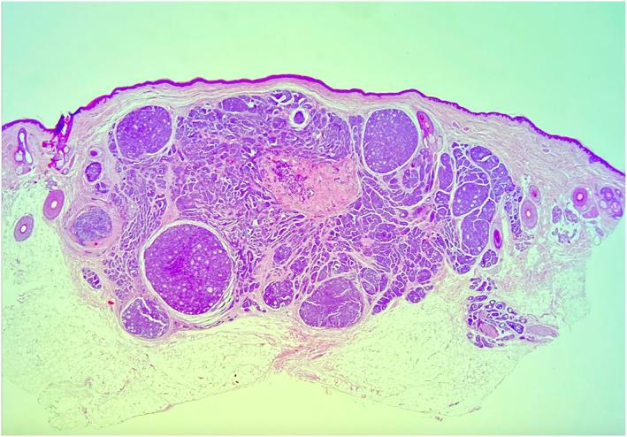 https://cdn.ncbi.nlm.nih.gov/pmc/blobs/9b4c/9168016/756dc0c42c4f/SKI2-2-e118-g004.jpg