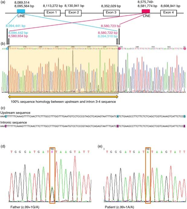 https://cdn.ncbi.nlm.nih.gov/pmc/blobs/9b4f/4230412/1066fb747f1c/dmcn0056-1124-f2.jpg