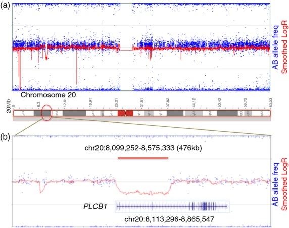 https://cdn.ncbi.nlm.nih.gov/pmc/blobs/9b4f/4230412/e4de58c3f692/dmcn0056-1124-f1.jpg