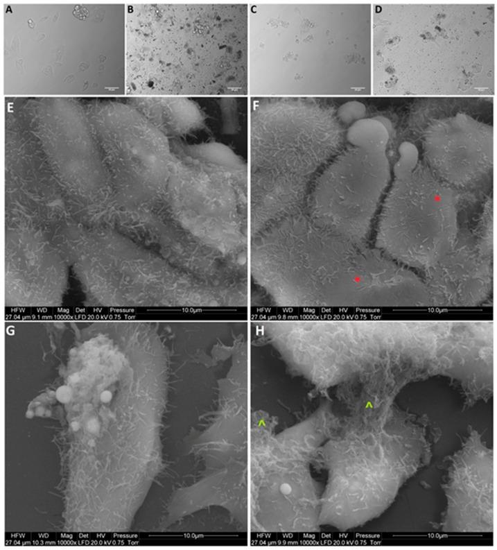 https://cdn.ncbi.nlm.nih.gov/pmc/blobs/9b4f/6470683/6ec6ef786dc2/materials-12-00909-g006.jpg