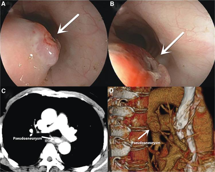 https://cdn.ncbi.nlm.nih.gov/pmc/blobs/9b51/8635267/7a68df5f48dd/gastnu-44-458-g001.jpg