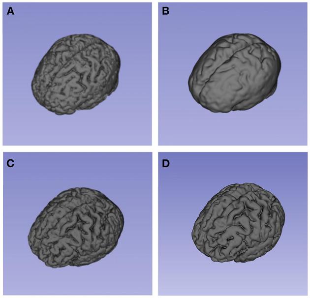 https://cdn.ncbi.nlm.nih.gov/pmc/blobs/9b54/8531099/acc2a00a2512/fneur-12-654419-g0004.jpg