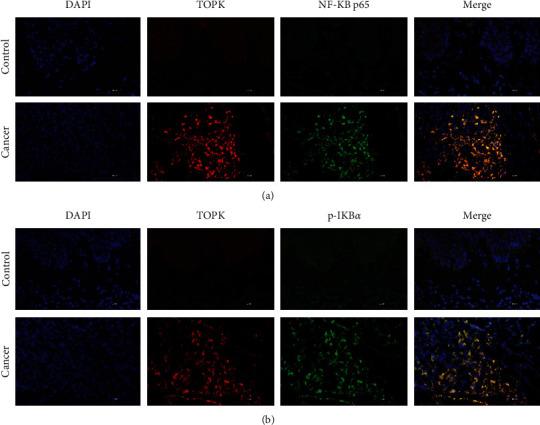 https://cdn.ncbi.nlm.nih.gov/pmc/blobs/9b5d/9217538/46f36c477904/DM2022-3771711.002.jpg