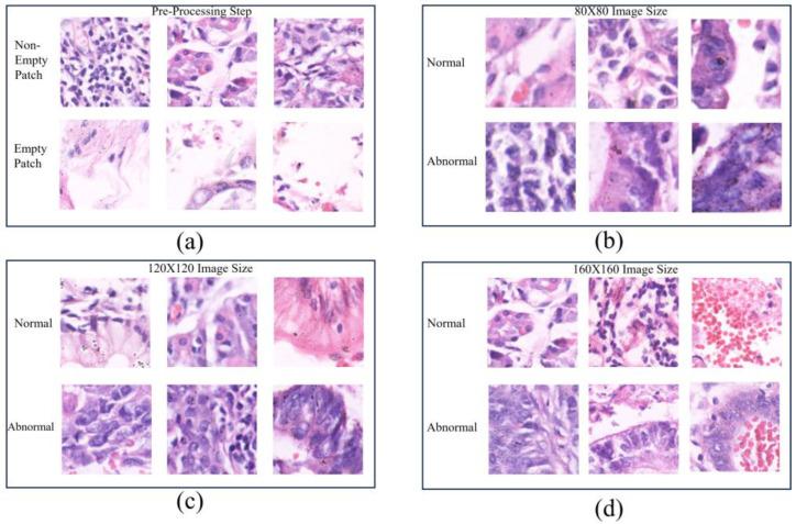 https://cdn.ncbi.nlm.nih.gov/pmc/blobs/9b5e/11354078/cfd9d56af1a1/diagnostics-14-01746-g002.jpg