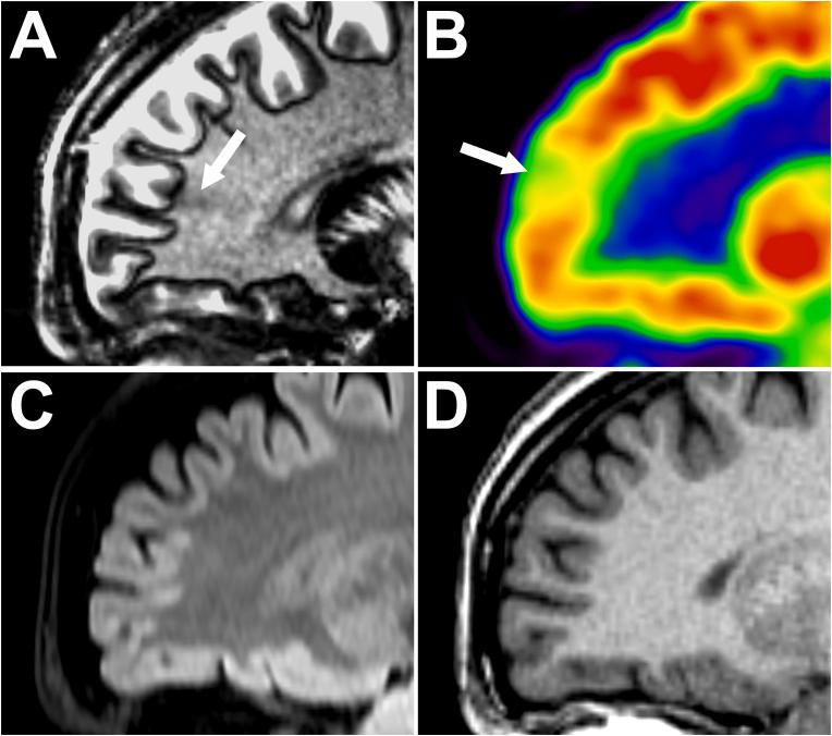 https://cdn.ncbi.nlm.nih.gov/pmc/blobs/9b65/12172902/272a22cc767c/gr3.jpg