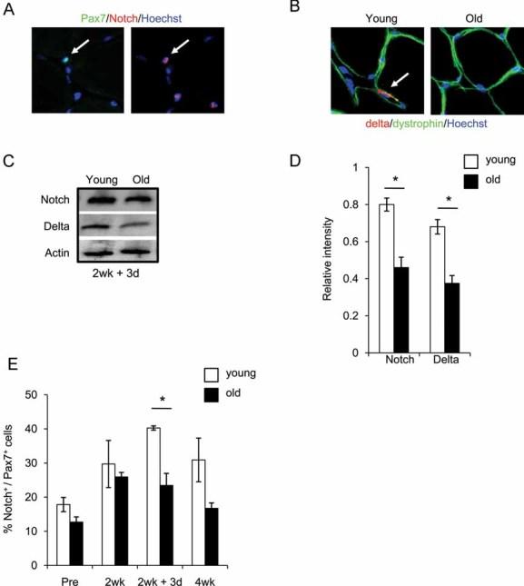 https://cdn.ncbi.nlm.nih.gov/pmc/blobs/9b68/3378152/1eb4f18b4610/emmm0001-0381-f3.jpg