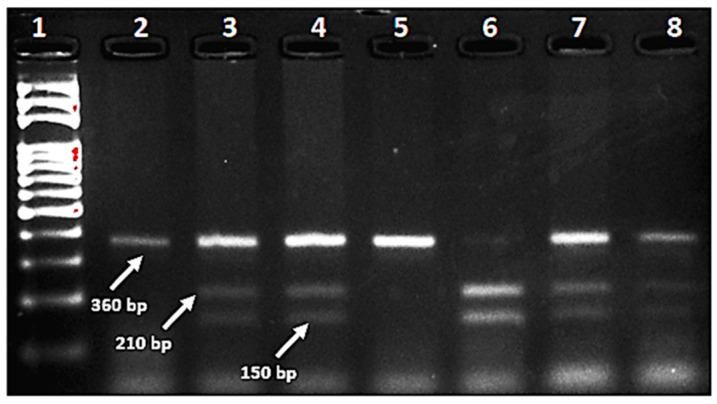 https://cdn.ncbi.nlm.nih.gov/pmc/blobs/9b6b/10779477/46a05d0058d5/jcm-13-00219-g001.jpg