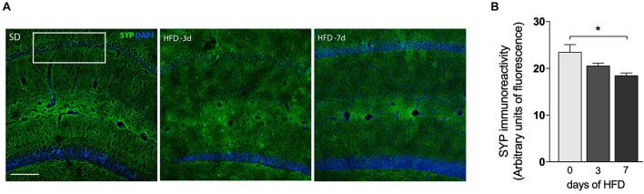 https://cdn.ncbi.nlm.nih.gov/pmc/blobs/9b71/8600238/932ee847c969/fnins-15-734158-g004.jpg