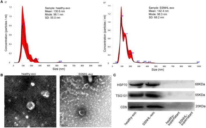 https://cdn.ncbi.nlm.nih.gov/pmc/blobs/9b75/10273844/2c236c15b3cd/fneur-14-1177988-g0001.jpg